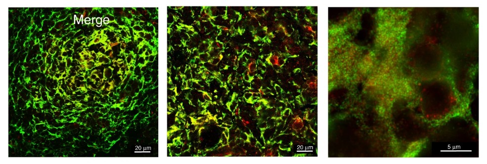 Estudo aponta como células B se mobilizam para combater infecção. Acima: células estudadas pelo cientistas destacadas com propriedade fluorescente (Foto: Nature Communications/University of York)