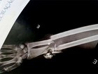 Raio-X mostra ossos partidos de garota vítima de bala perdida no RN