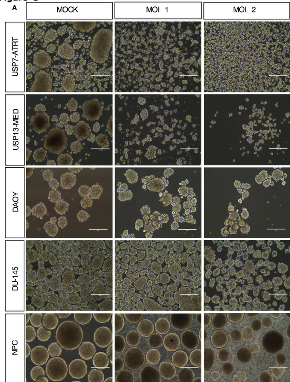 Imagem retirada do estudo mostra a ação do zika sobre células do tumor. As imagens mais à esquerda vão mostrando a ação do zika progressivamente. O vírus vai desorganizando as esferas das células tumorais  (Foto: Kaid et al)