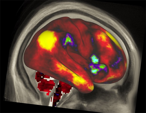 Imagem de atividade cerebral registrada por pesquisadores (Foto: NIH/Divulgação)