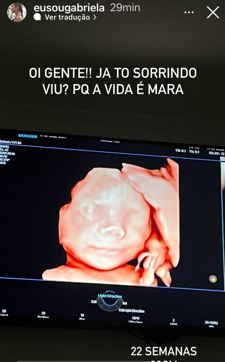 Gabriela Pugliesi mostra ultrassom do filho e se derrete (Foto: Reprodução / Instagram)