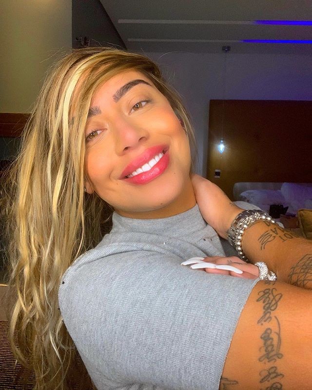 Rafaella Santos mostra preenchimento labial (Foto: Reprodução / Instagram)