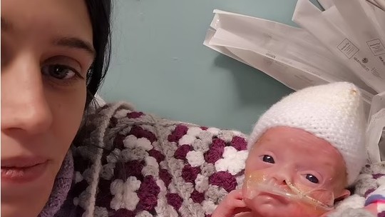 Médicos dizem que bebê tinha morrido no útero, mas mãe insiste e dá à luz "bebê milagre"