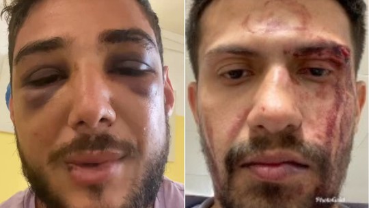 'Tentaram me assassinar', diz brasileiro espancado e torturado por seguranças de casa noturna em Portugal
