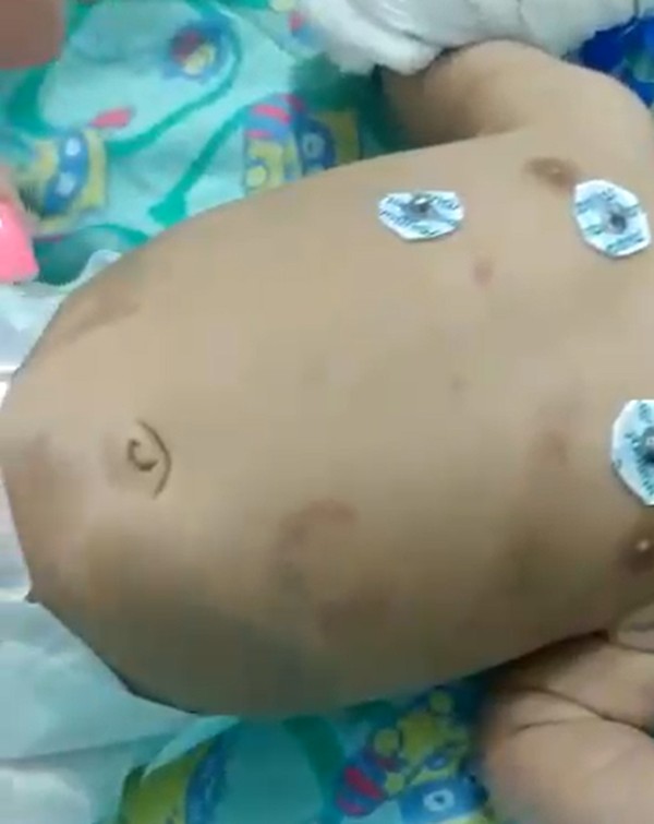 Bebe De 2 Meses Fica Em Estado Grave Apos Ser Espancado Pelo Pai Por Chorar Demais Segundo A Policia Norte Fluminense G1