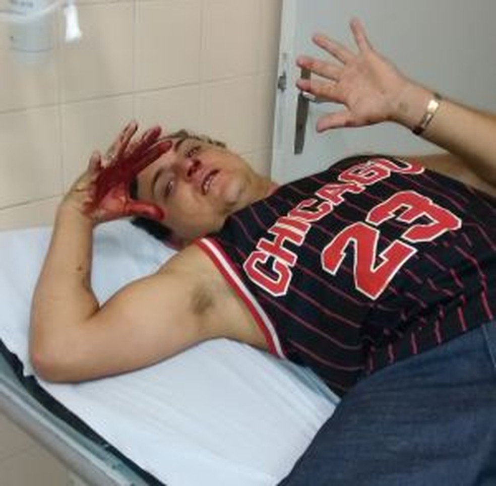 Jovem foi encaminhado para o pronto-socorro após agressão  — Foto: Arquivo pessoal/Diego Adelino Siqueira 