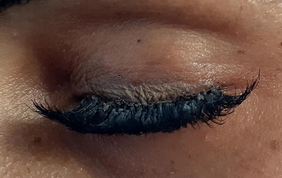 Mulher sofre lesões nos olhos depois de colocar cílios postiços em clínica de estética em Porto Velho — Foto: Facebook/divulgação