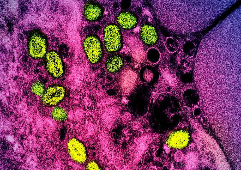 Micrografia eletrônica de transmissão colorida de partículas do vírus da varíola dos macacos (amarelo) encontradas dentro de uma célula infectada (rosa), cultivadas em laboratório.
