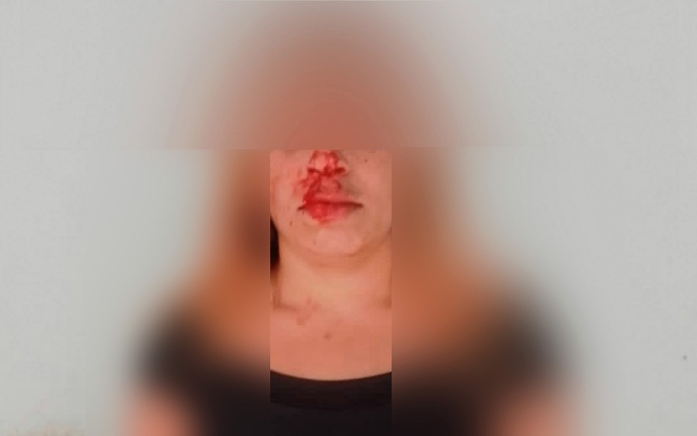 Moradora de Americana diz ter sido agredida por vereador — Foto: Arquivo pessoal