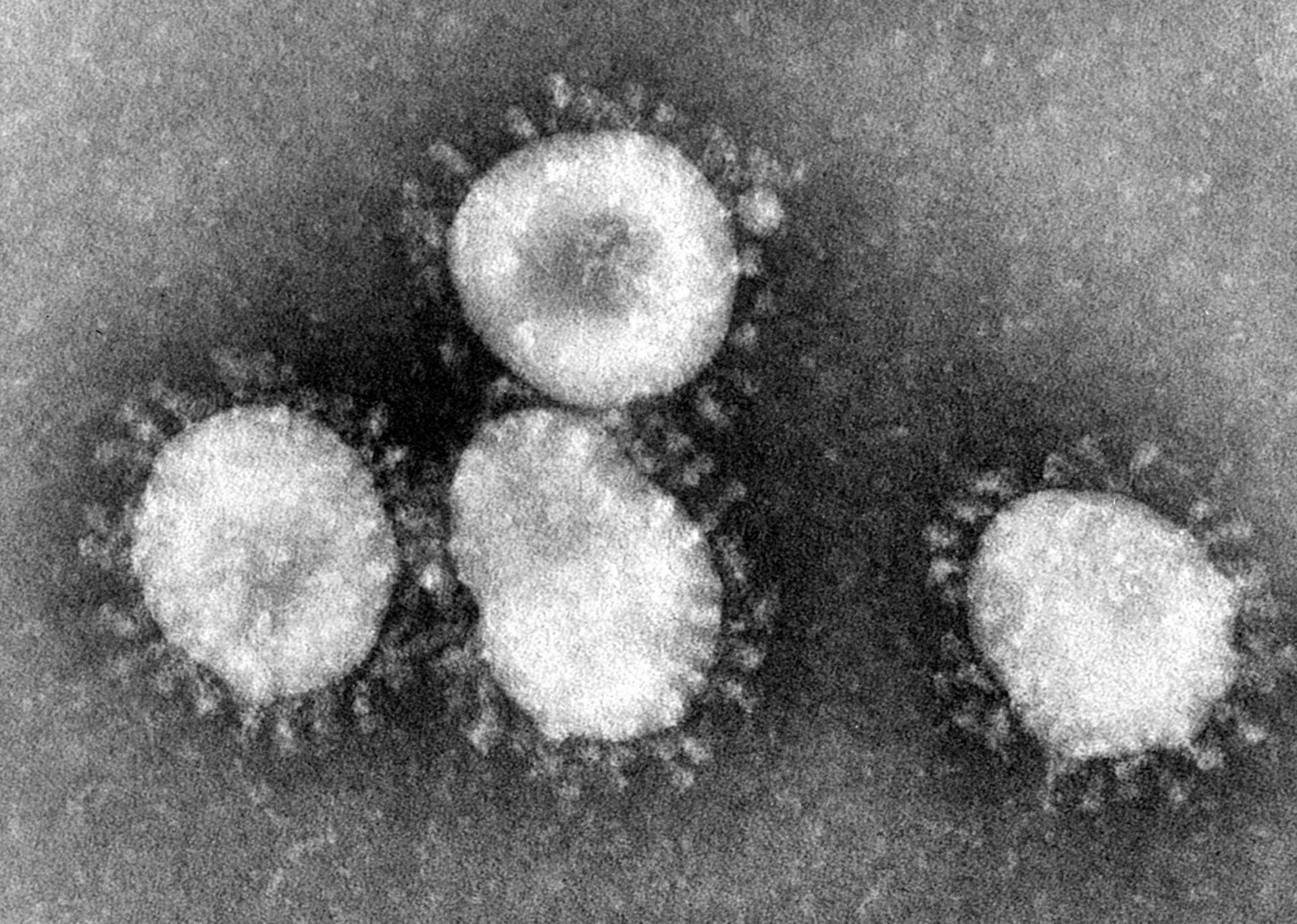 O nome coronavírus foi dado em razão do formato de coroa que sua imagem tem (Foto: Wikimedia Commons)