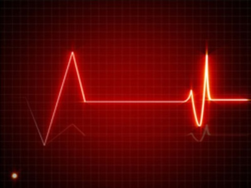 Proteção de Tela: Electrocardiogram | Download | TechTudo
