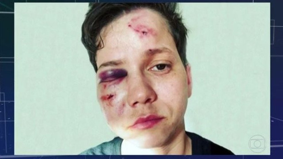 Youtuber Karol Eller mostrou as lesões no rosto — Foto: Reprodução