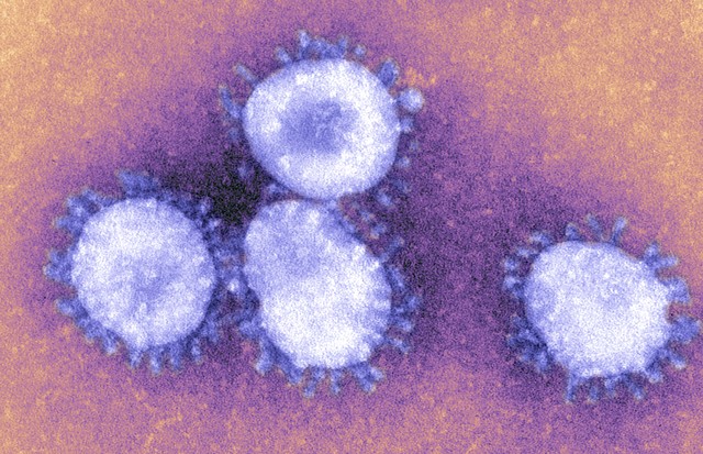 The Coronaviruses Owe Their Name To The The Crown Like Projections, Visible Under Microscope, That Encircle The Capsid. The Coronaviruses Are Responsible For Respiratory Ailments And Gastro Enteritis. The Virus Responsible For Sars Belongs To This Family. (Foto: Universal Images Group via Getty)