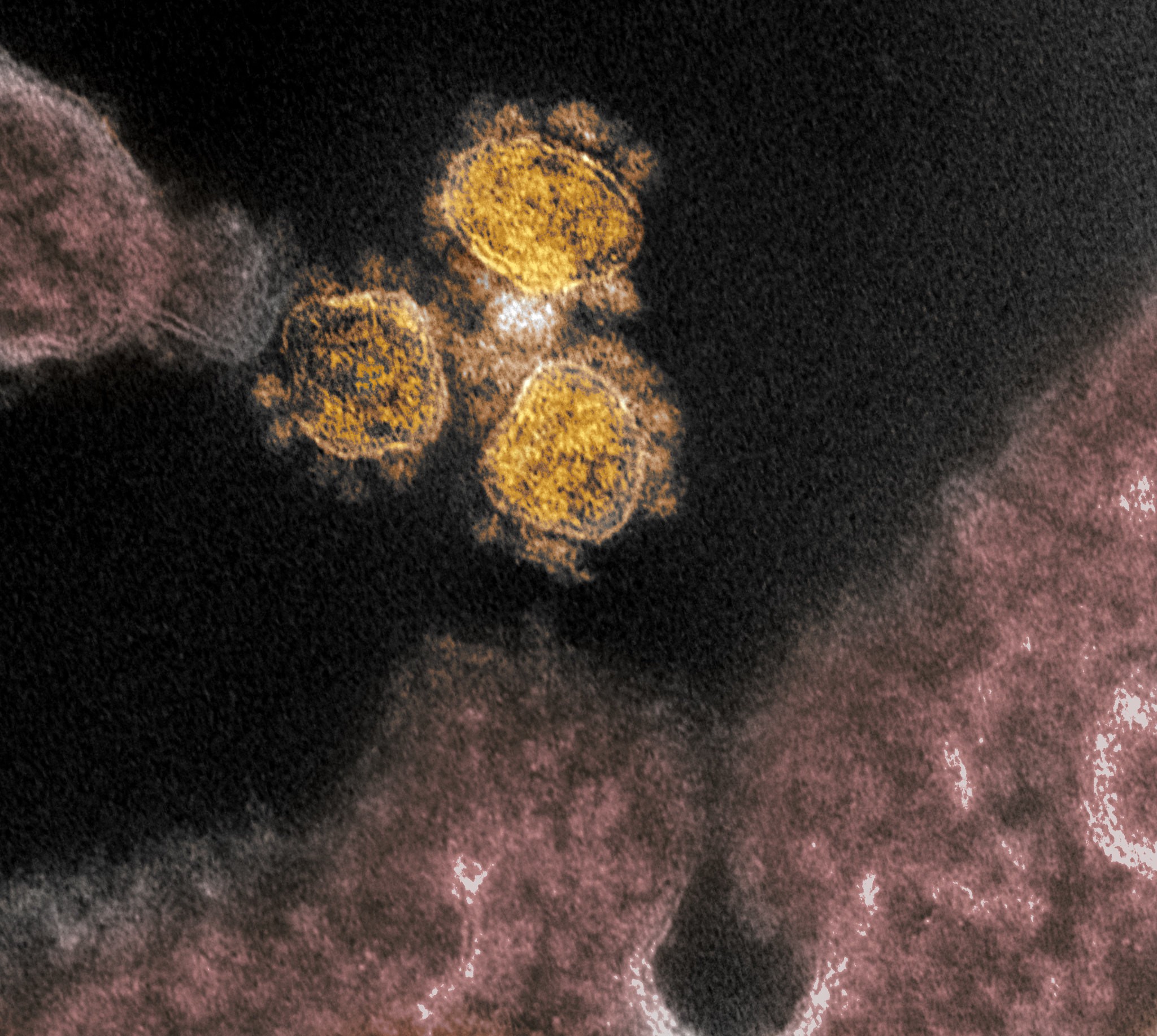coronavírus covid-19 sars-cov-2 (Foto: NIAID)