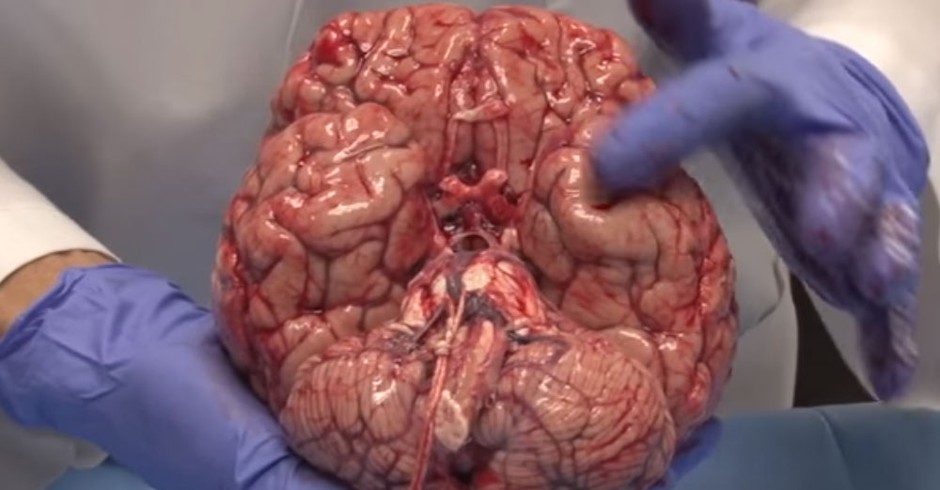 Cérebro (Foto: Reprodução/ YouTube)