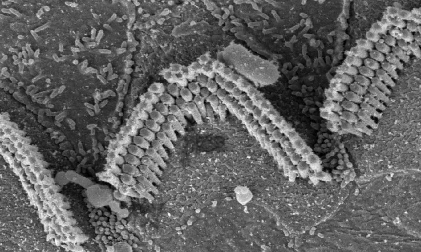 Um close nas células capilares (Foto: Wikimedia Commons)
