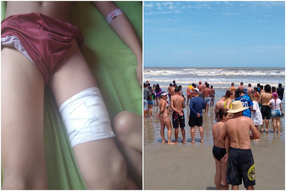 Menino fica ferido ao ser atacado por tubarão em Ilha Comprida, SP — Foto: Reprodução/Redes Sociais e Página Rócio Um Bom Lugar Iguape