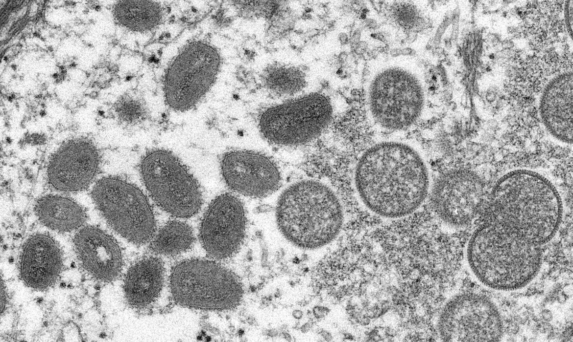 Estudo relata o primeiro uso de antivirais em pacientes com varíola dos macacos (Foto: Cynthia S.Goldsmith )