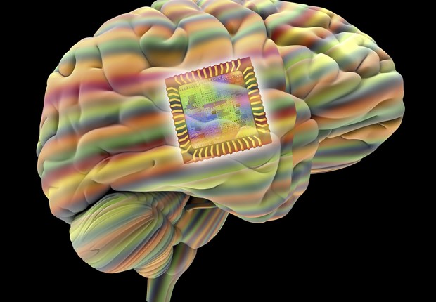 Cérebro com chip  (Foto: Getty Images)