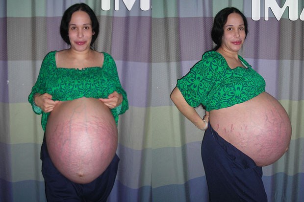 Nadya Suleman na reta final da gravidez, em 2009 (Foto: TMZ)