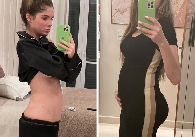 Bárbara Evans mostra mudanças no corpo durante tratamento de fertilização (Foto: Reprodução/Instagram)