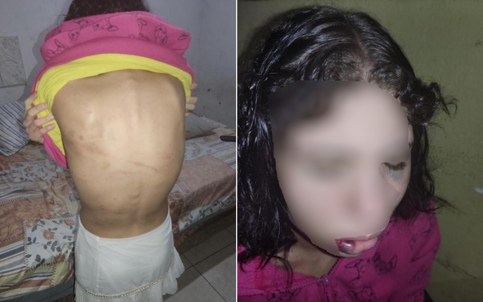 Adolescente é agredida e namorado é suspeito, em Anápolis — Foto: Reprodução/TV Anhanguera