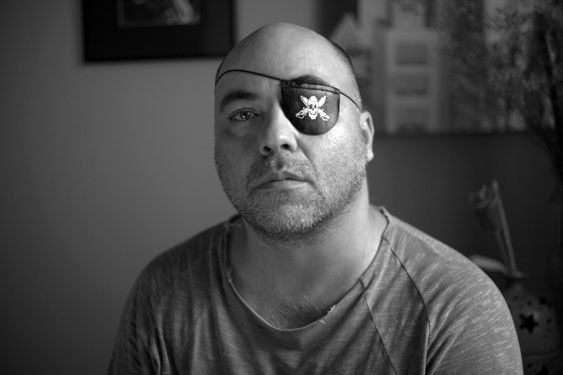 O fotógrafo Alex Silveira, que perdeu quase toda a visão do olho esquerdo após tiro de bala de borrcha em protesto (Foto: Sérgio Silva/Divulgação)