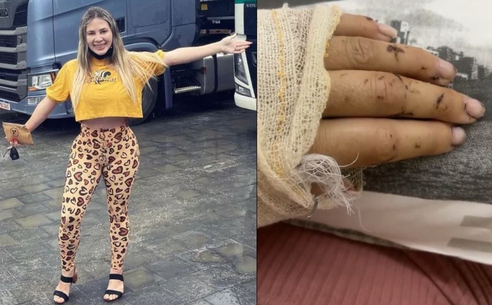 'Musa das Estradas' em frente a caminhão envolvido no acidente e mão machucada dela um mês depois — Foto: Montagem/Arquivo pessoal/Reprodução/Redes sociais