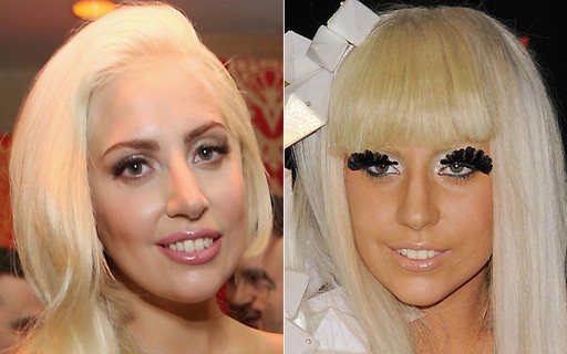 LADY GAGA ANTES E DEPOIS DA HARMONIZAÇÃO FACIAL