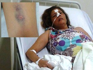 Sobrinha de paciente denúncia médico de UPA de São Pedro (Foto: Katia Dourado)