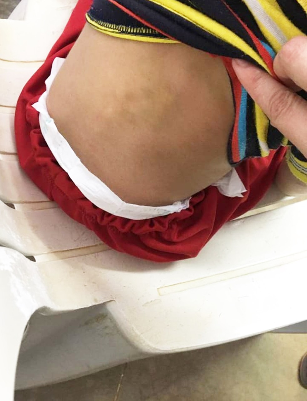 CrianÃƒÂ§a apresentava hematomas pelo corpo Ã¢â‚¬â€ Foto: PolÃƒÂ­cia Civil do RN/DivulgaÃƒÂ§ÃƒÂ£o