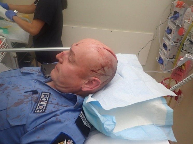 Policial ferido na cabeça com espada samurai