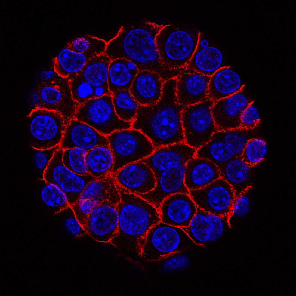 Células de câncer de pâncreas (núcleos em azul) crescendo dentro de membrana (vermelho) — Foto: National Institute of Health (NIH)