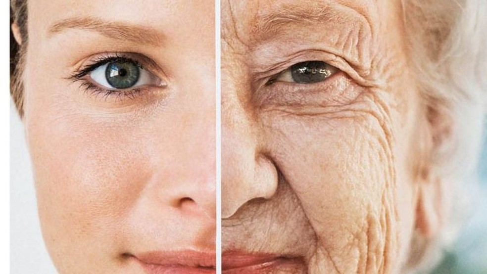 O envelhecimento se nota principalmente pela perda de volume no rosto — Foto: Getty Images via BBC
