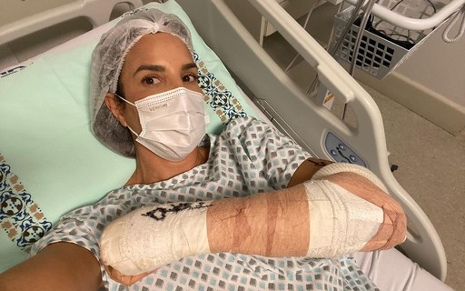 Ivete Sangalo passa por cirurgia no braço após lesão e mostra foto no pós-operatório
