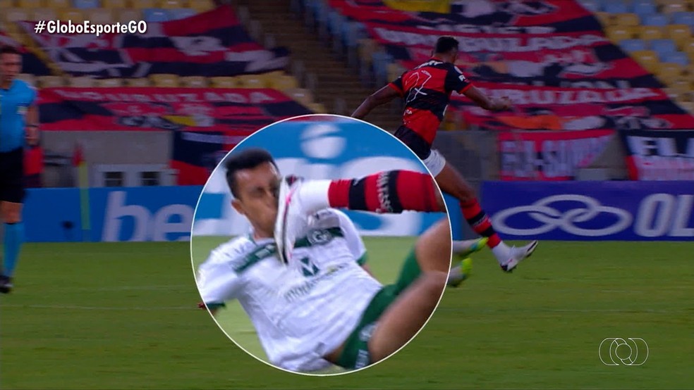 Volante Breno, do Goiás, quebra o nariz após disputa com Bruno Henrique — Foto: Reprodução / TV Anhanguera