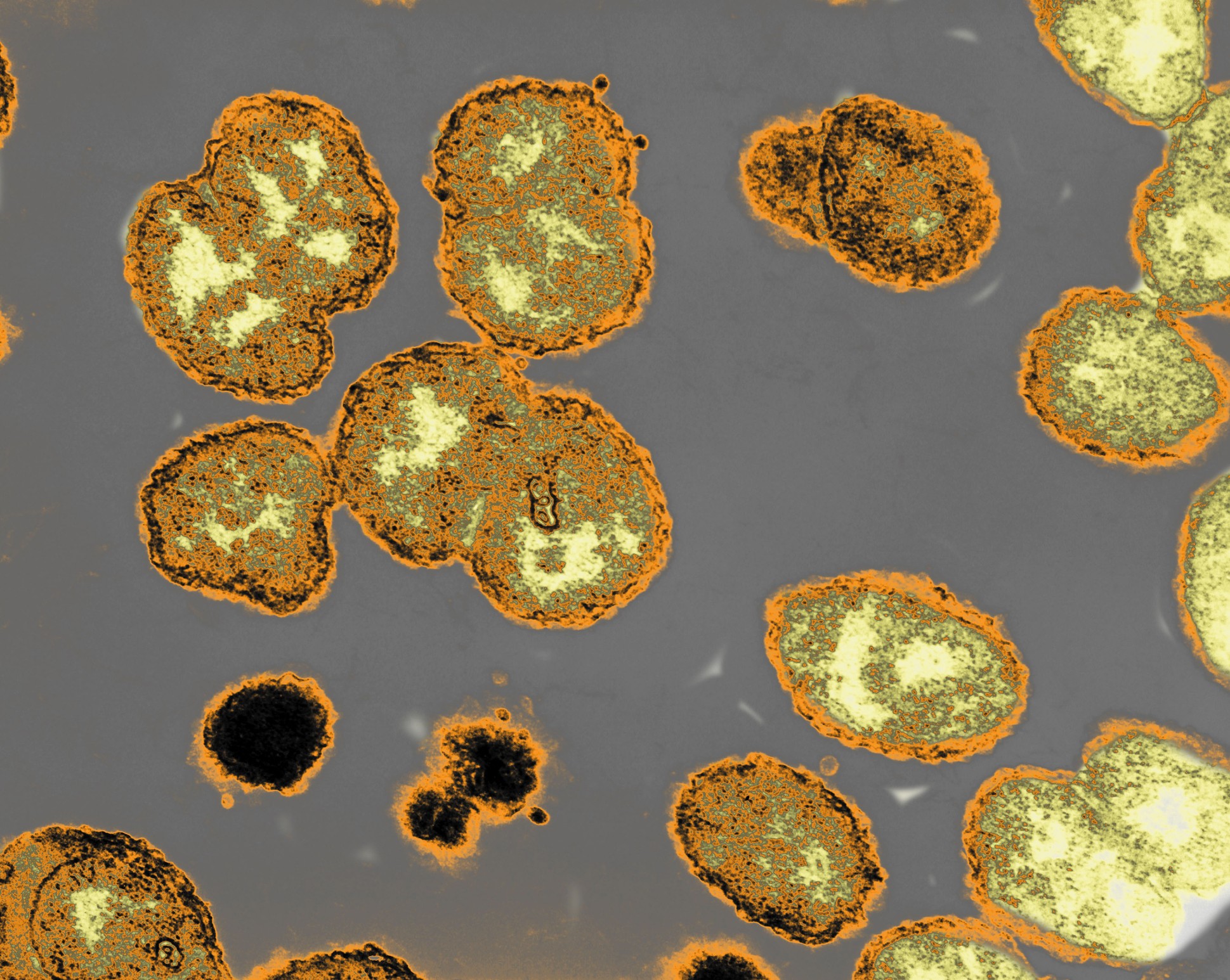 A Neisseria gonorrhoeae, bactéria responsável pela doença (Foto: Getty Images)