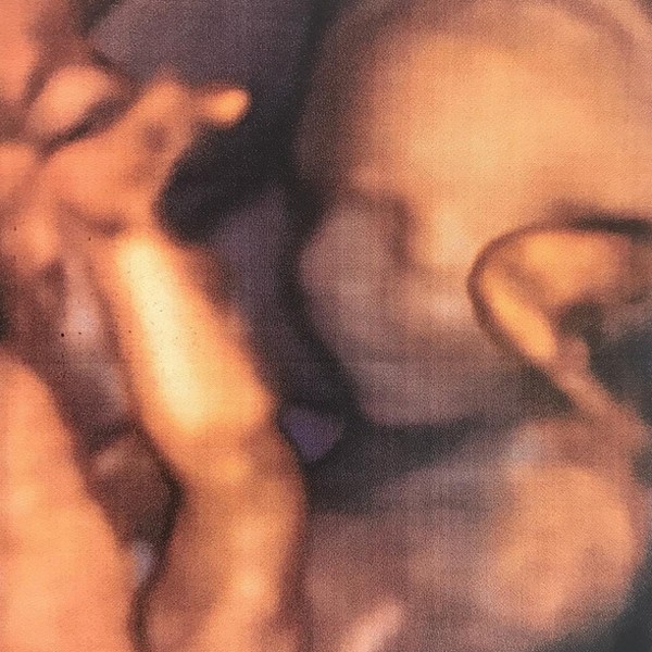 Eliana mostra ultrassonografia de sua filha (Foto: Reprodução / Instagram)