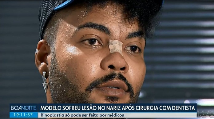 Modelo sofre lesão no nariz após fazer rinoplastia com dentista e CRO-PR  suspende registro da profissional | Paraná | G1