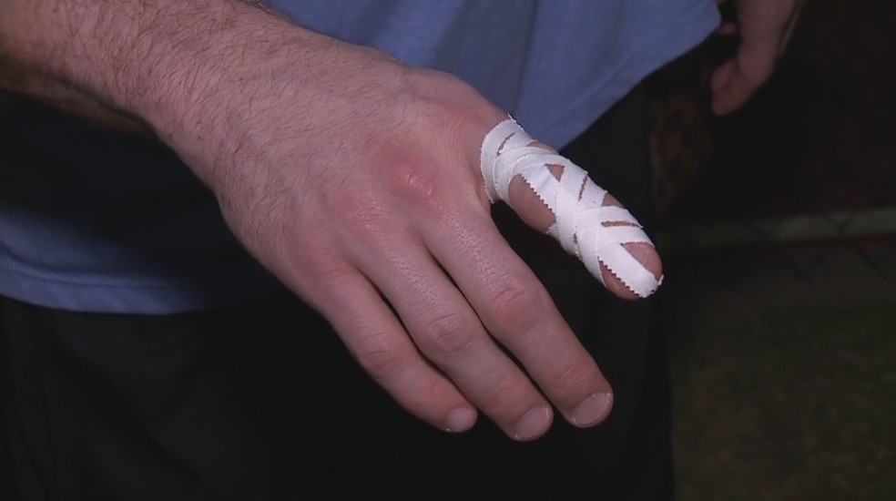 Goleiro mostra curativo em dedo machucado — Foto: Reprodução / RBS TV