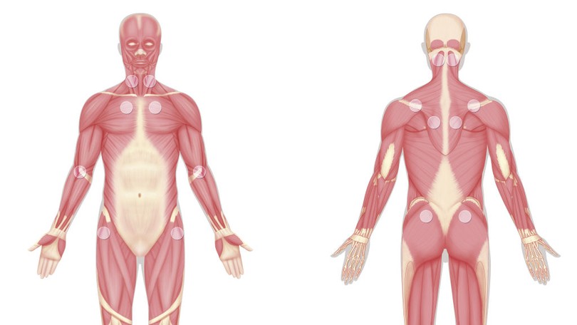 O Que E Fibromialgia Conheca Sintomas Tratamento E Causas Saude Ge
