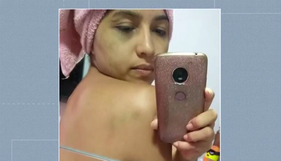 Jessyka Laynara, 25, enviou fotos à amiga para mostrar marca de agressões (Foto: TV Globo/Reprodução)