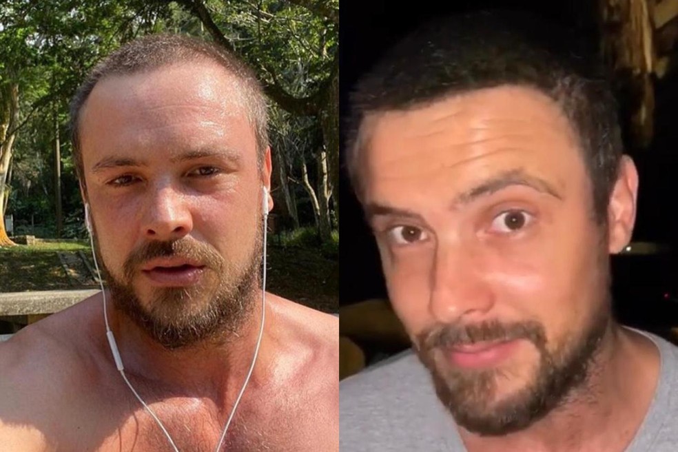 Sérgio Guizé antes e depois do transplante capilar  — Foto: Reprodução/Instagram