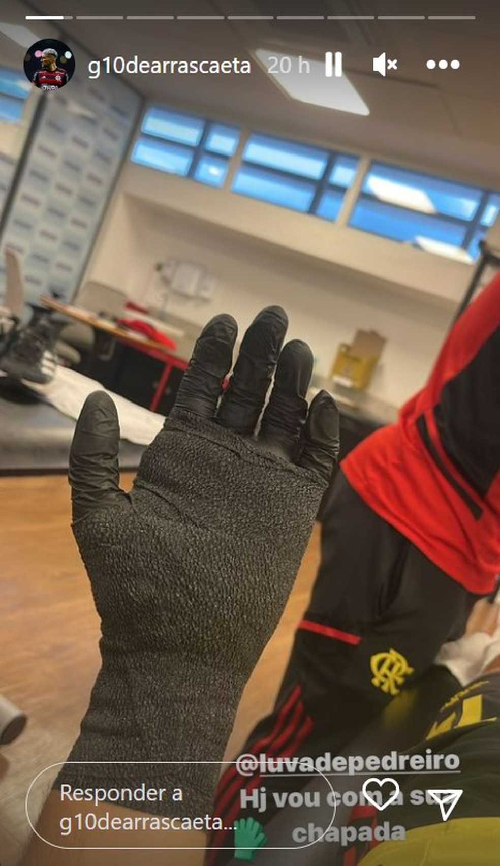 Com curativo na m&atilde;o, Arrascaeta brinca com Luva de Pedreiro nas redes sociais  &mdash; Foto: Arquivo pessoal