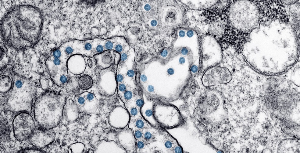 Imagem obtida por um microscópio eletrônico mostra o primeiro caso americano de COVID-19  — Foto: Hannah A Bullock e Azaibi Tamin/CDC/Divulgação via Reuters