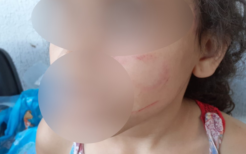 Menina de 6 anos é agredida no rosto pelo namorado da mãe que estava bêbado, em Goiânia — Foto: Reprodução/Conselho Tutelar