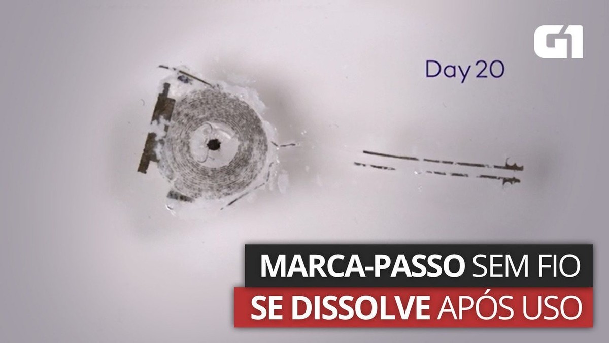 Cientistas desenvolvem marcapasso sem fio que se dissolve no corpo | Viva você