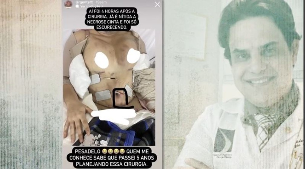 Mulheres que tiveram sequelas e complicações após cirurgias plásticas denunciam médico — Foto: Reprodução