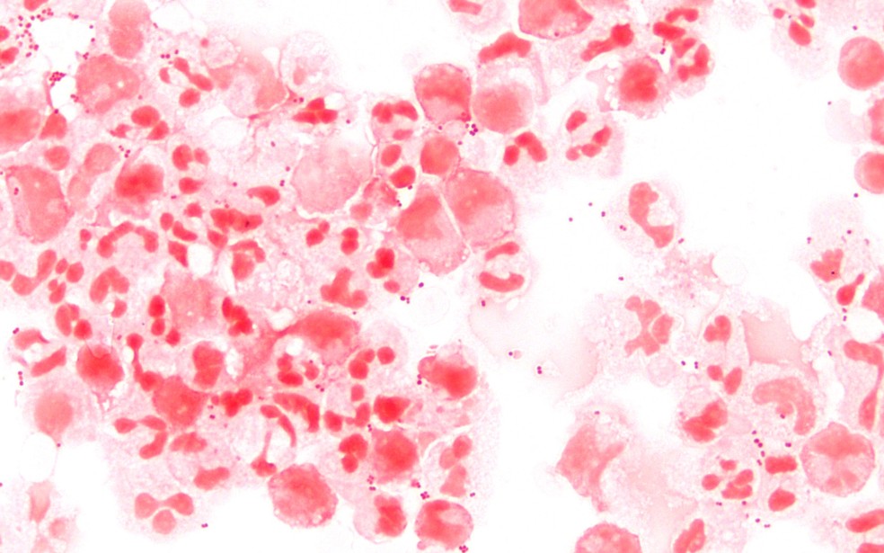 Neisseria meningitidis, a bactéria que causa a meningite meningocócica. — Foto: Wikimedia