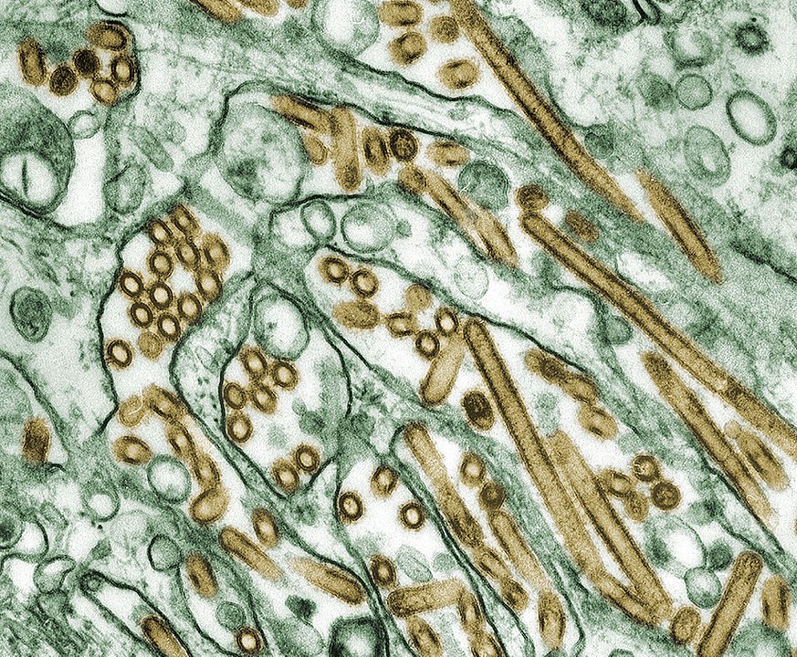 Vírus da gripe do subtipo H5N1 (em amarelo) crescendo em uma cultura celular (verde) (Foto: CDC)